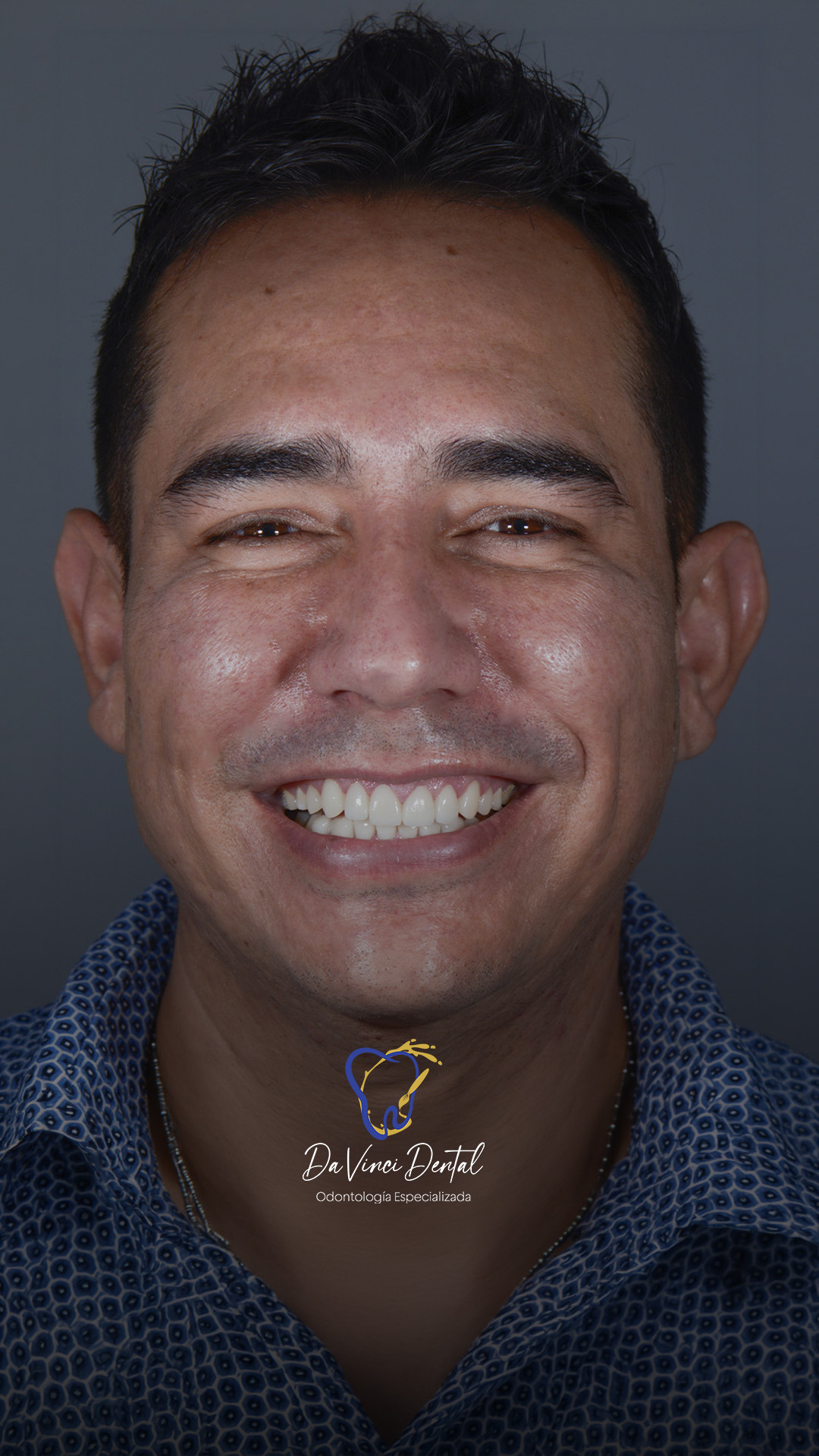 Testimonial Aldo - Da Vinci Dental